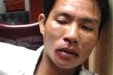 Về thăm gia đình, đối tượng che chắn camera trộm tài sản sa lưới