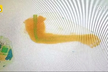 Nhân viên an ninh sốc khi phát hiện... hai cánh tay người trong túi của khách