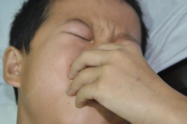 Tính mạng cậu bé dân tộc Sán Chỉ nguy kịch do khối u thân đốt sống ngực