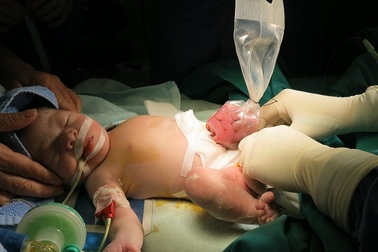 Phẫu thuật cứu sống trẻ sơ sinh nội tạng nằm ngoài ổ bụng