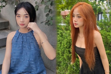 Nữ sinh Bắc Giang có hai màu mắt: Trải qua 5 lần phẫu thuật vẫn yêu đời