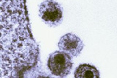 Phát hiện gen ngăn chặn vi rút HIV tái tạo