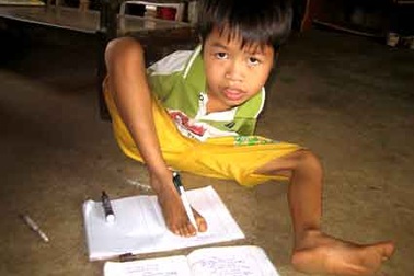 Đôi chân kỳ diệu của cậu học sinh tật nguyền