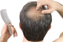 Da đầu khỏe, tóc mọc nhanh nhờ liệu pháp chăm sóc da đầu tại Petunia Charm Center