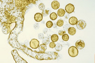 Phát hiện 1 protein khống chế virus viêm gan C