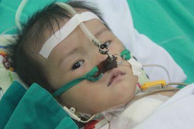 Bé Hoàng Lê Khánh Thy đã được phẫu thuật tim thành công