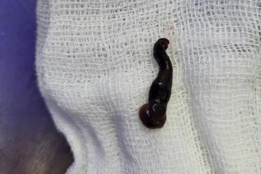 Đi khám vì chảy máu mũi, bất ngờ phát hiện sinh vật "sống nhờ" suốt 2 tháng