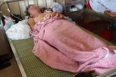 Gọi hàng xóm ra mở cửa lúc rạng sáng, cầm dao đâm thấu vai