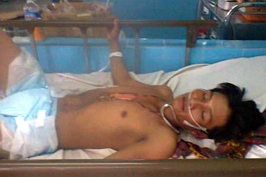 Bị sét đánh nguy kịch khi đang làm đồng