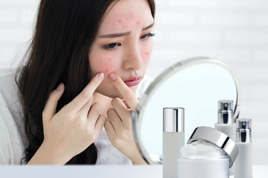 O2 SKIN - 3 yếu tố làm nên câu chuyện thương hiệu "chuyên trị mụn"