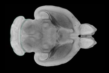 Phát hiện ra cơ chế chi phối đến việc uống rượu quá mức