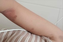 Người vợ trẻ tử vong nghi do bị chồng bạo hành