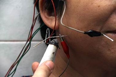 Thực hư về gió độc