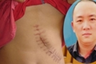 Làm giấy tờ giả, môi giới mua bán thận trái phép