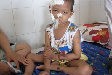 Thương cậu bé 5 tuổi toàn thân “bầm dập” vì bệnh ung thư máu