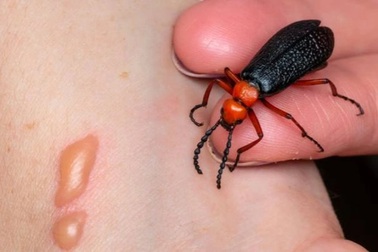 Người đàn ông nguy kịch sau khi ăn món "tăng cường sinh lý"