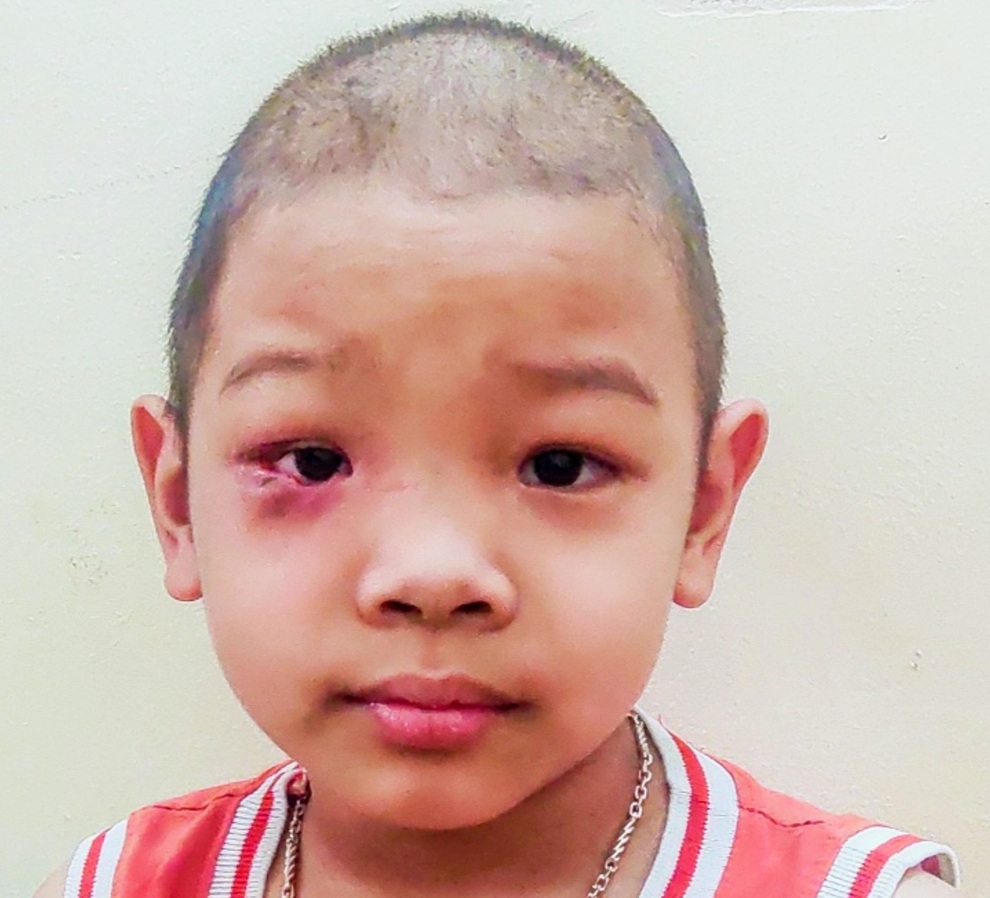 Cậu bé 7 tuổi tái ung thư: Mẹ vào thuốc... con mới sống được - 6 Cậu bé 7 tuổi tái ung thư: Mẹ vào thuốc... con mới sống được - 6