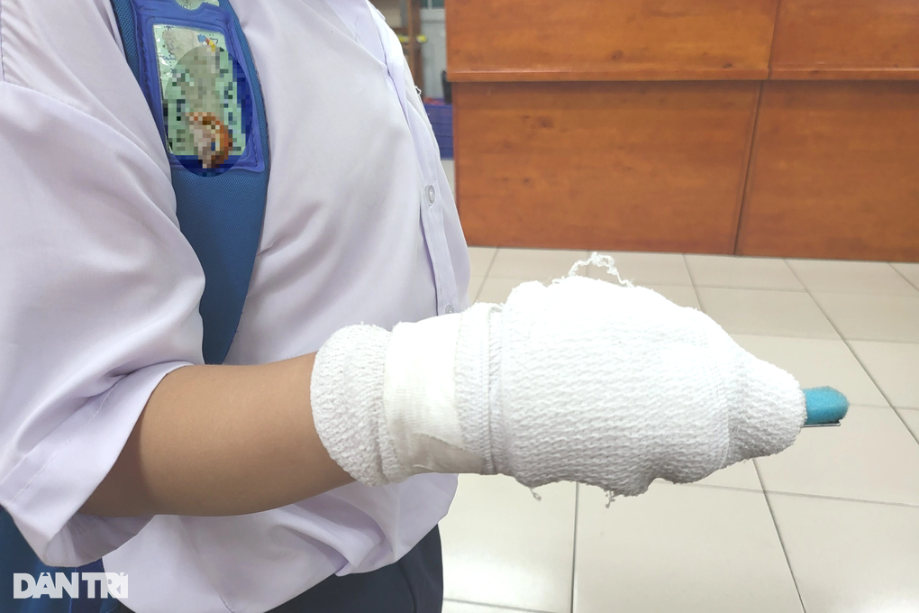 Nghi giáo viên đánh gãy ngón tay học sinh, lãnh đạo trường họp khẩn - 1 Nghi giáo viên đánh gãy ngón tay học sinh, lãnh đạo trường họp khẩn - 1