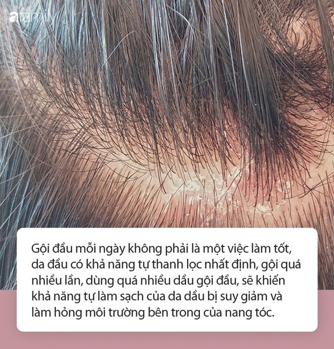 Những bộ phận này trên cơ thể “bẩn” sẽ có lợi cho sức khỏe, quá sạch sẽ phản tác dụng - Ảnh 3. Những bộ phận này trên cơ thể “bẩn” sẽ có lợi cho sức khỏe, quá sạch sẽ phản tác dụng - Ảnh 3.
