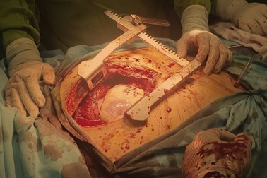 Nam thanh niên bị người yêu đâm xuyên tim, thấu phổi