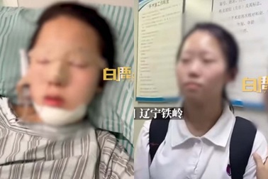 Tranh cãi bà mẹ Trung Quốc đưa con gái đi thẩm mỹ để cai nghiện game