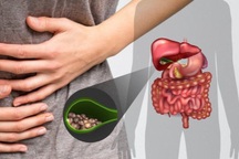 3 thắc mắc thường gặp về bệnh ung thư