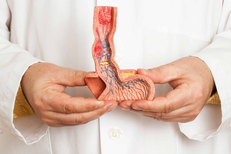 Quý ông có mất “của quý” khi điều trị ung thư dương vật? - 1 Quý ông có mất “của quý” khi điều trị ung thư dương vật? - 1