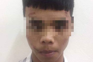 Bị doạ cướp, cô gái bình tĩnh làm đối tượng bất tỉnh