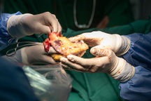 "Trận đánh" của hơn 60 y bác sĩ để chàng trai Hà Nội tái sinh 6 cuộc đời