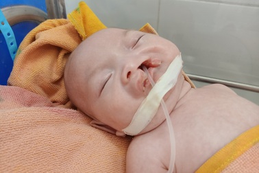 Đau nhói lòng cảnh hài nhi hở hàm ếch bị bố mẹ nhẫn tâm bỏ rơi