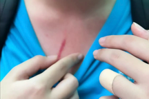 Từ vụ bạo lực tại trường quốc tế: Cách bảo vệ con khi bị bạn đánh ở trường