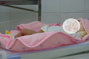 Sau sinh, cha mẹ bàng hoàng phát hiện con không có hậu môn