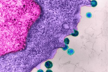 Dùng thuốc kháng vi rút sớm, tăng cơ hội sống cho người có HIV