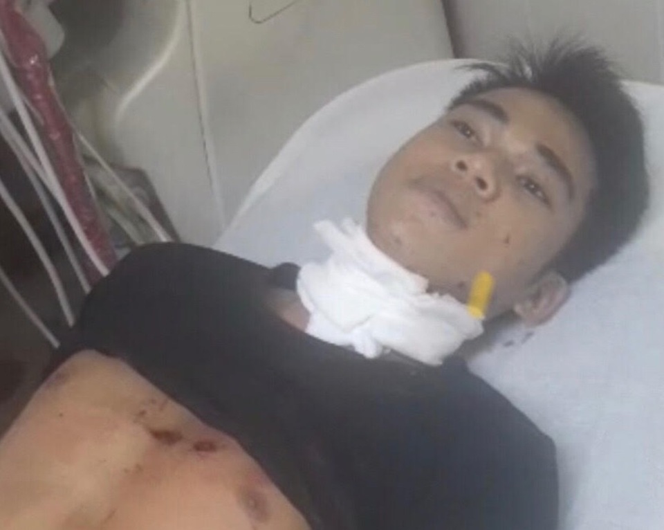 Người phụ nữ trẻ bị giết trong nhà nghỉ - 1 Người phụ nữ trẻ bị giết trong nhà nghỉ - 1