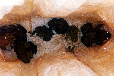 Ăn cháo cóc, 3 mẹ con tử vong