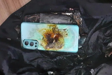 Mới mua hơn 2 tuần, smartphone bất ngờ phát nổ khiến chủ nhân bị thương