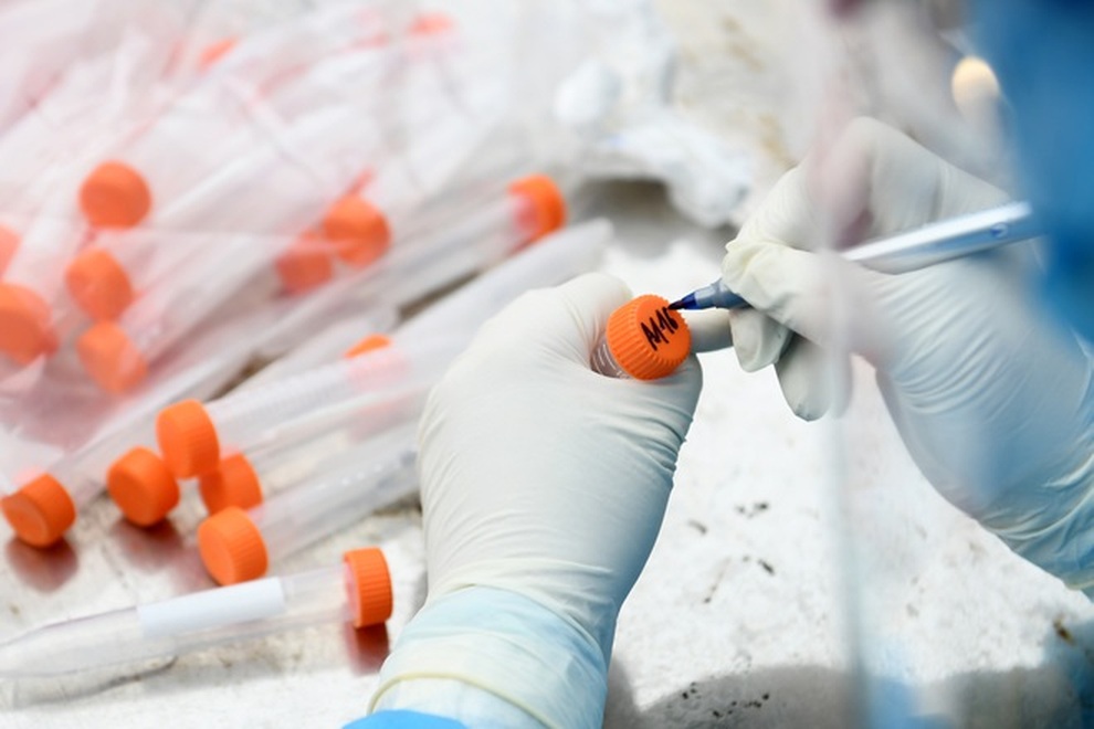 Ngày 12/8, Hà Nội triển khai xét nghiệm truy vết Covid-19 trên diện rộng - 2