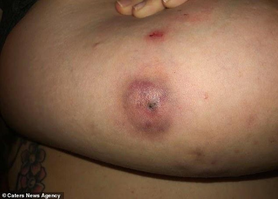 Bà mẹ 29 tuổi khổ sở vì bộ ngực khổng lồ - 2 Bà mẹ 29 tuổi khổ sở vì bộ ngực khổng lồ - 2