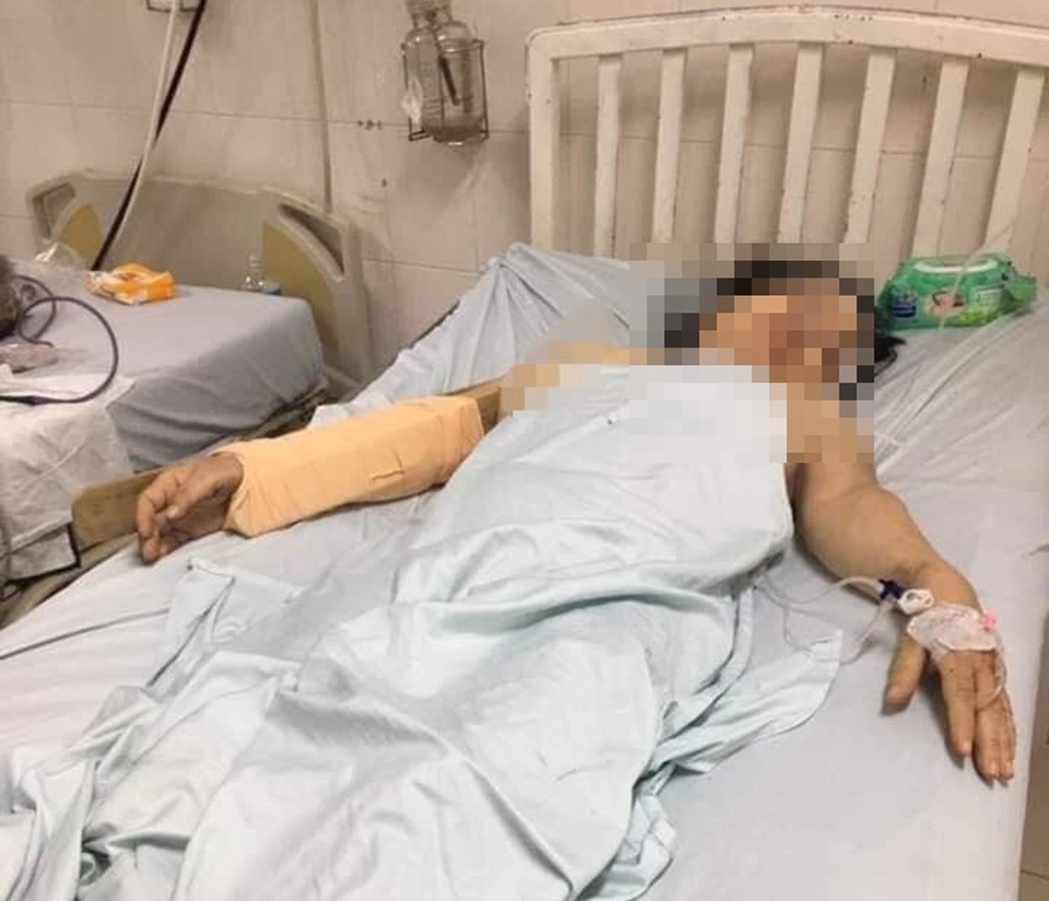 Khởi tố, bắt tạm giam người đàn ông dùng gậy đánh vợ cũ dã man - 3 Khởi tố, bắt tạm giam người đàn ông dùng gậy đánh vợ cũ dã man - 3
