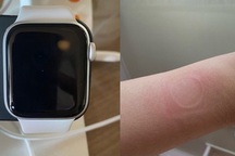 Đồng hồ “giá rẻ” Apple Watch SE khiến người dùng bị bỏng do quá tải nhiệt