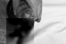 Hà Nội: Cho tay vào máy ép hoa quả, bé gái 2 tuổi dập nát bàn tay