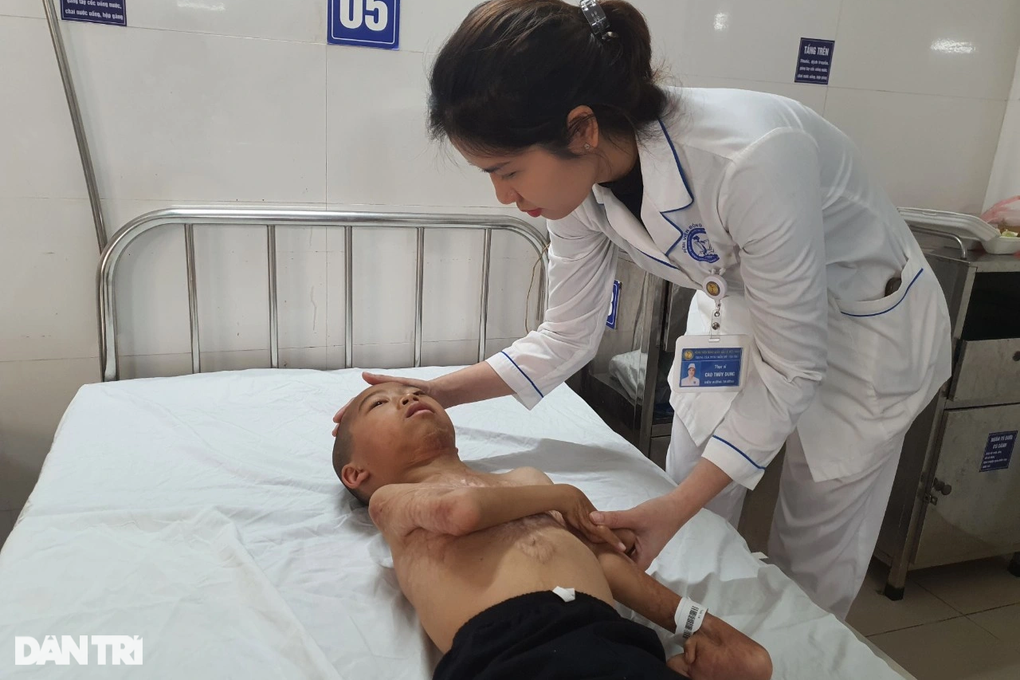 Nghẹn đắng trước cơ thể biến dạng khủng khiếp do bỏng của bé trai 14 tuổi - 2 Nghẹn đắng trước cơ thể biến dạng khủng khiếp do bỏng của bé trai 14 tuổi - 2