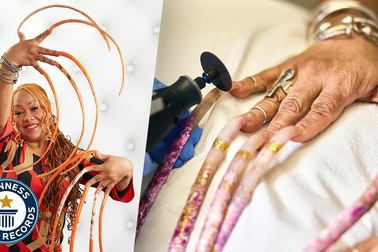 "Nhẹ cả người" vì cắt đi bộ móng lập Kỷ lục Guinness Thế giới