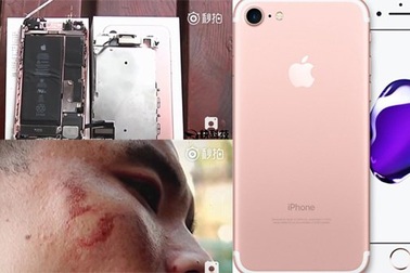 iPhone 7 phát nổ khi quay video, kính văng rách mặt