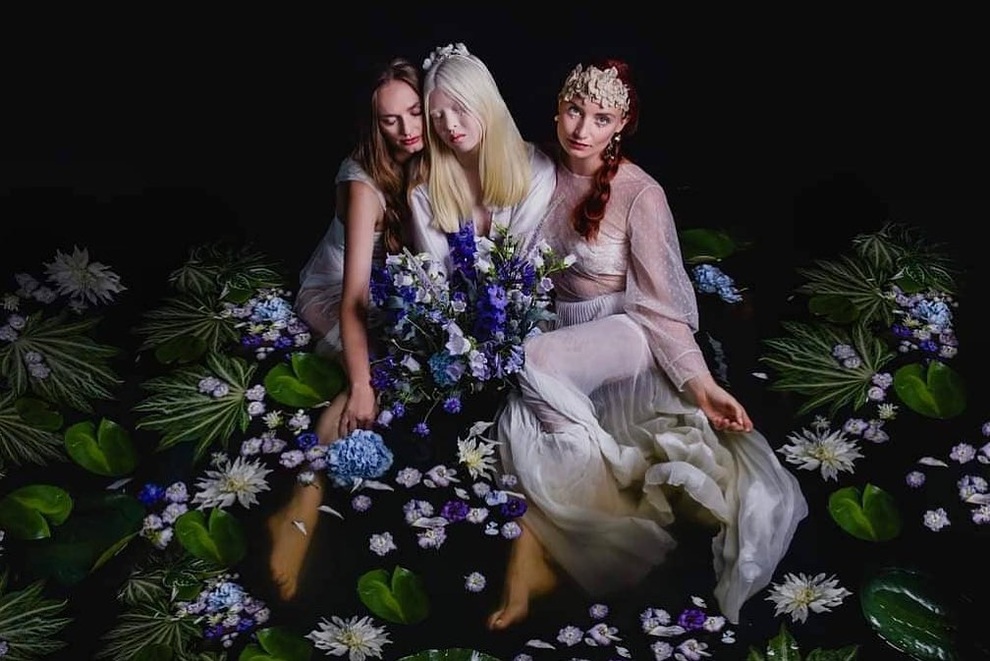 Cô gái bạch tạng từng bị cha mẹ bỏ rơi, trở thành người mẫu tạp chí Vogue - 1