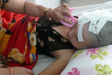 Bị đánh hội đồng đến chấn thương sọ não vì "nhìn thấy ghét"