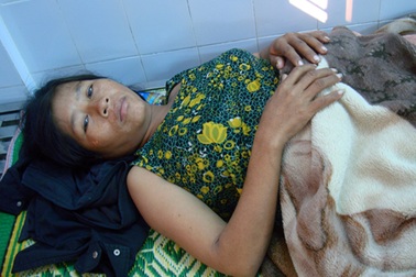 Cứu sống sản phụ mang thai lần thứ 8 bị nhau bong non