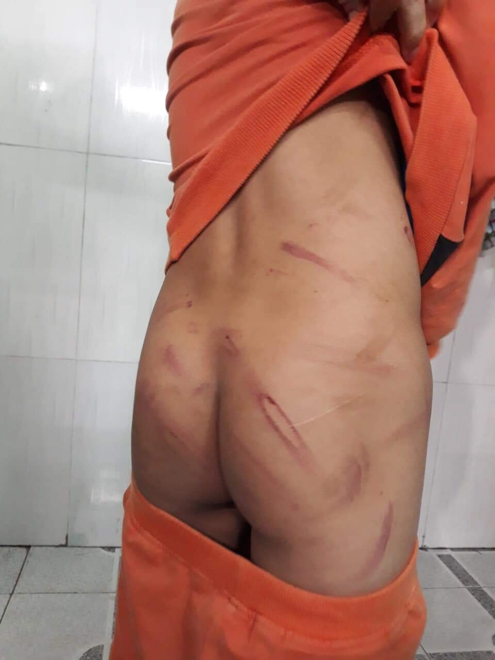 Cha đánh con lớp 1 thâm tím vì học không tiến bộ - 1 Cha đánh con lớp 1 thâm tím vì học không tiến bộ - 1