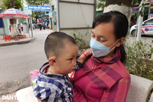 Cậu bé bị biến dạng khuôn mặt vì ngã vào chậu nước nóng đã được tới viện