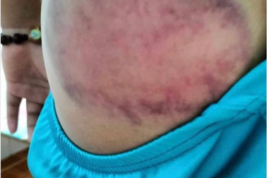 Nam sinh lớp 4 làm bể bong bóng, thầy giáo đánh 50 roi